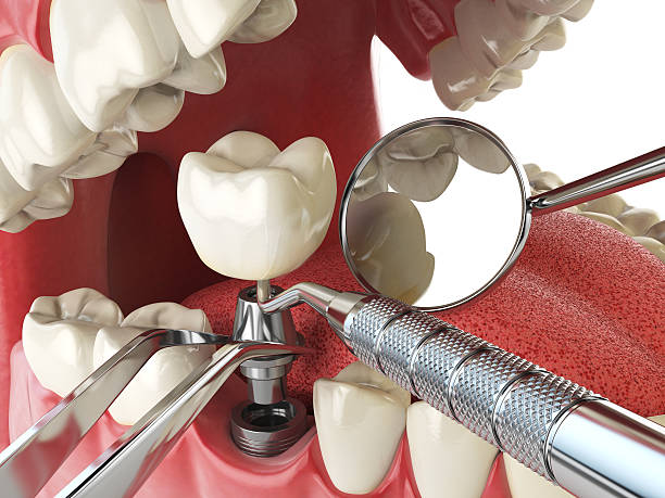 Best Broken or Cracked Tooth Emergency Dentist in Coal City, WV
